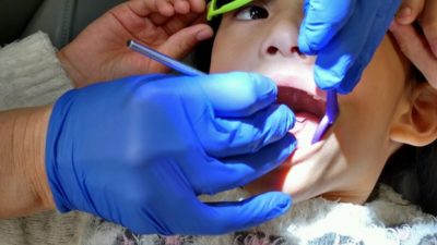 Oral Health Screening