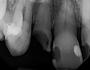 Read more about the article Heroic Dentistry: Saving the Day for Judy