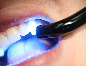 Read more about the article Shedding Some Light on LEDS