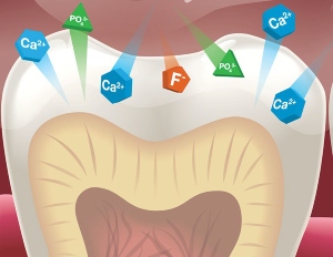 Read more about the article Four Myths About Fluoride Varnish