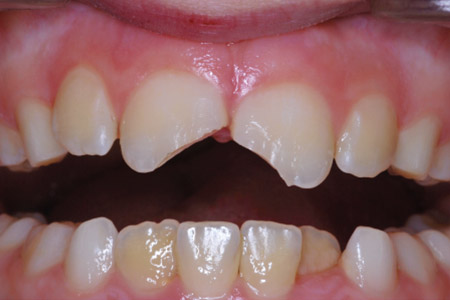 beforeafter1-1