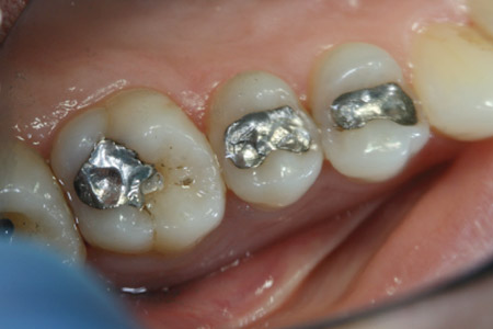 beforeafter2-1