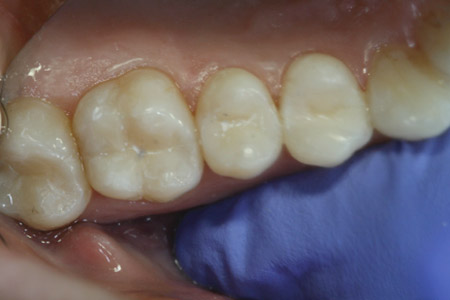 beforeafter2-2