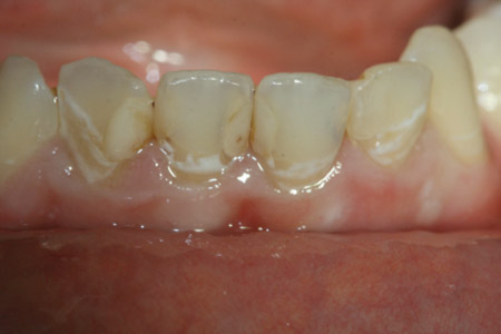 beforeafter3-1