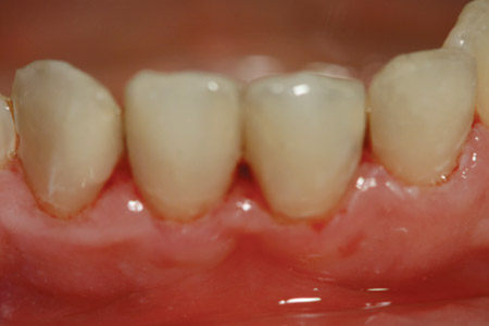 beforeafter3-2