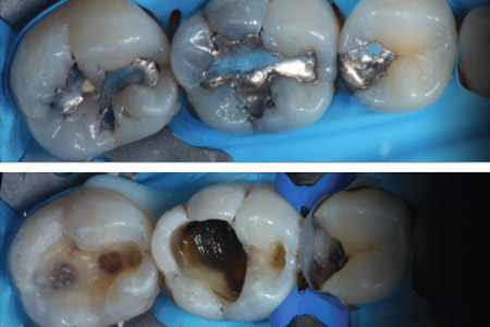 beforeafter4-1