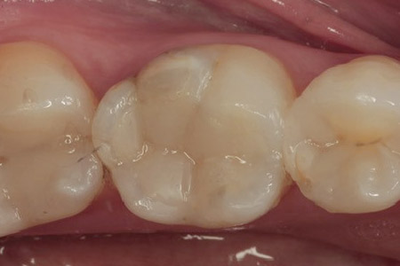 beforeafter4-2